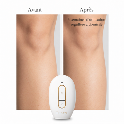 Lunara IPL – Épilation Permanente